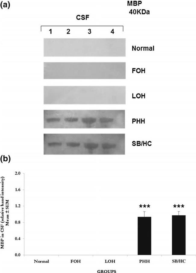 MBP Antibody in Western Blot (WB)