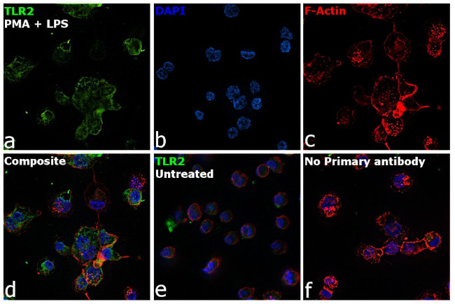 TLR2 Antibody in Immunocytochemistry (ICC/IF)