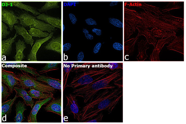 DJ-1 Antibody in Immunocytochemistry (ICC/IF)