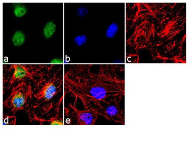 TRAIL-R2 (DR5) Antibody in Immunocytochemistry (ICC/IF)