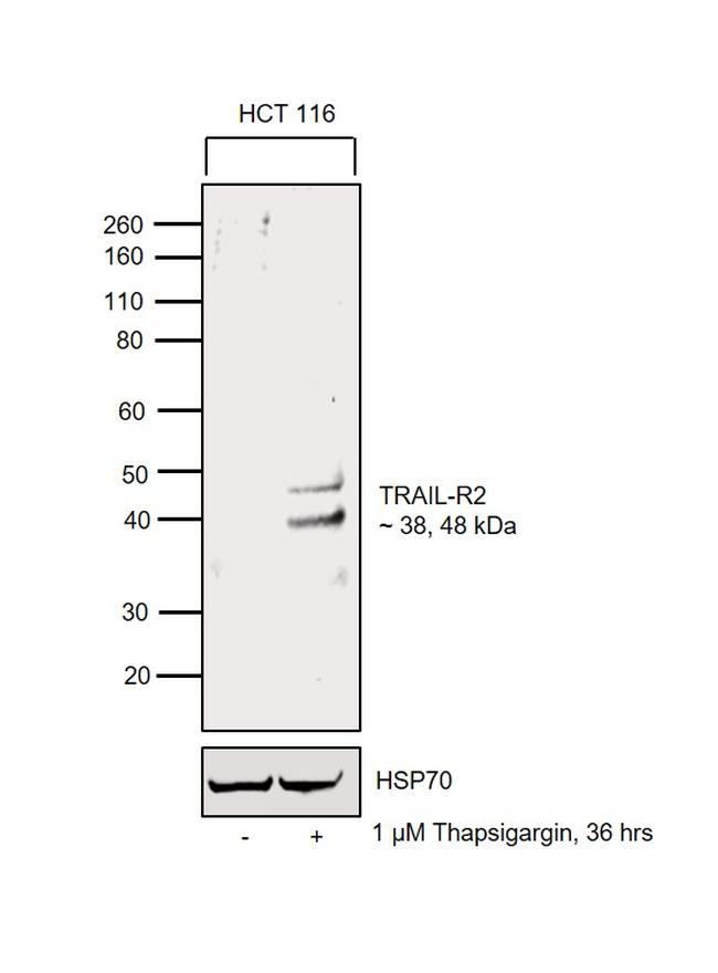 TRAIL-R2 (DR5) Antibody in Western Blot (WB)