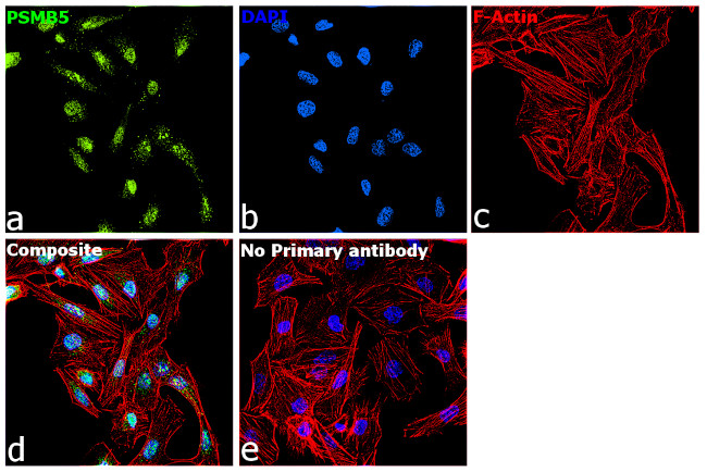 PSMB5 Antibody in Immunocytochemistry (ICC/IF)