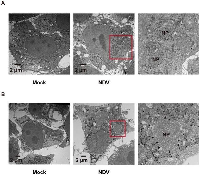 DYKDDDDK Tag Antibody in Immunohistochemistry (IHC)