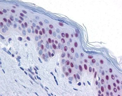 MRE11 Antibody in Immunohistochemistry (Paraffin) (IHC (P))