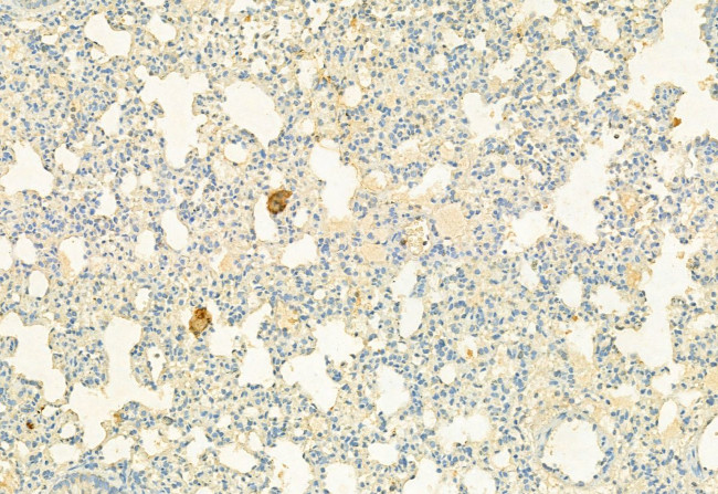 CD206 Antibody in Immunohistochemistry (Paraffin) (IHC (P))