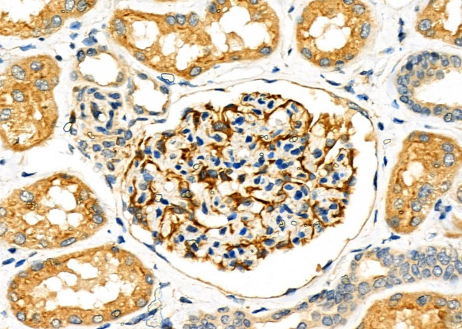 SLC27A2 Antibody in Immunohistochemistry (Paraffin) (IHC (P))