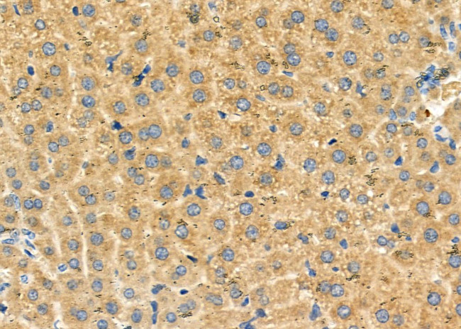 SLC27A2 Antibody in Immunohistochemistry (Paraffin) (IHC (P))