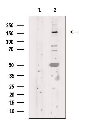 FANCD2 Antibody in Western Blot (WB)