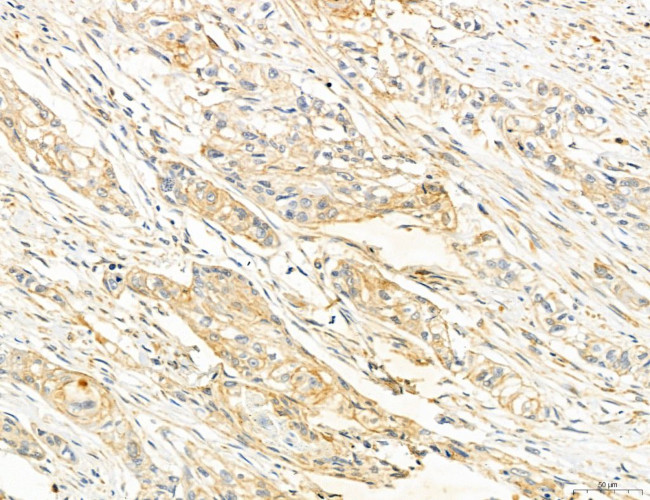 NOD2 Antibody in Immunohistochemistry (Paraffin) (IHC (P))