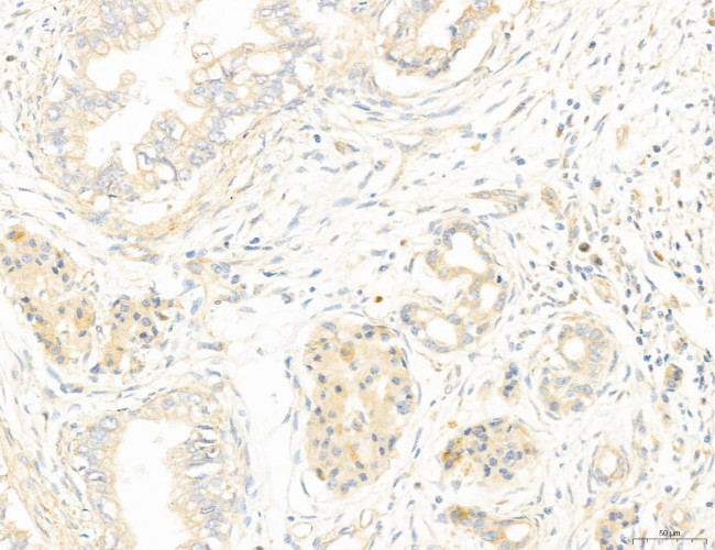 NOD2 Antibody in Immunohistochemistry (Paraffin) (IHC (P))