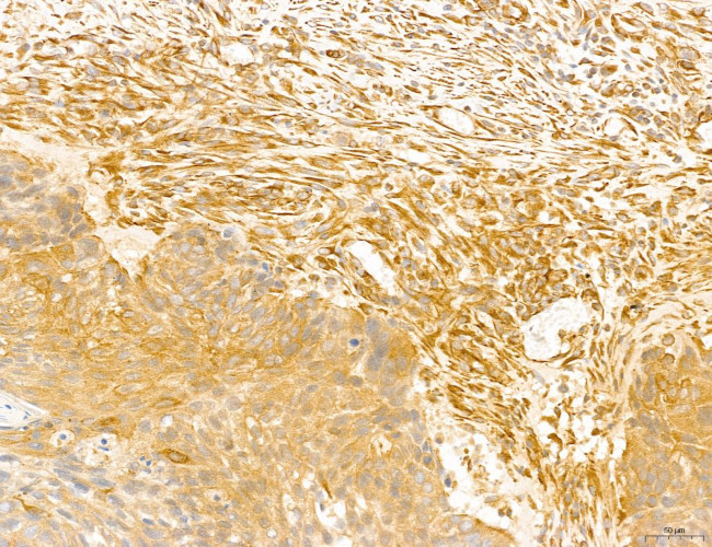 NOD2 Antibody in Immunohistochemistry (Paraffin) (IHC (P))