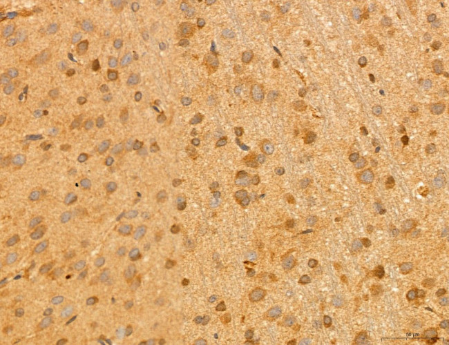 NOD2 Antibody in Immunohistochemistry (Paraffin) (IHC (P))