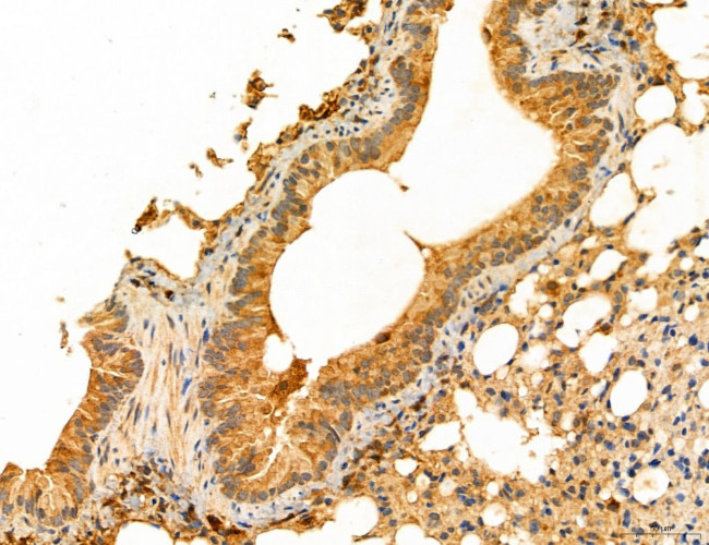 NOD2 Antibody in Immunohistochemistry (Paraffin) (IHC (P))