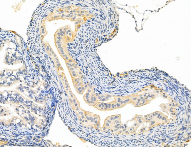 NOD2 Antibody in Immunohistochemistry (Paraffin) (IHC (P))