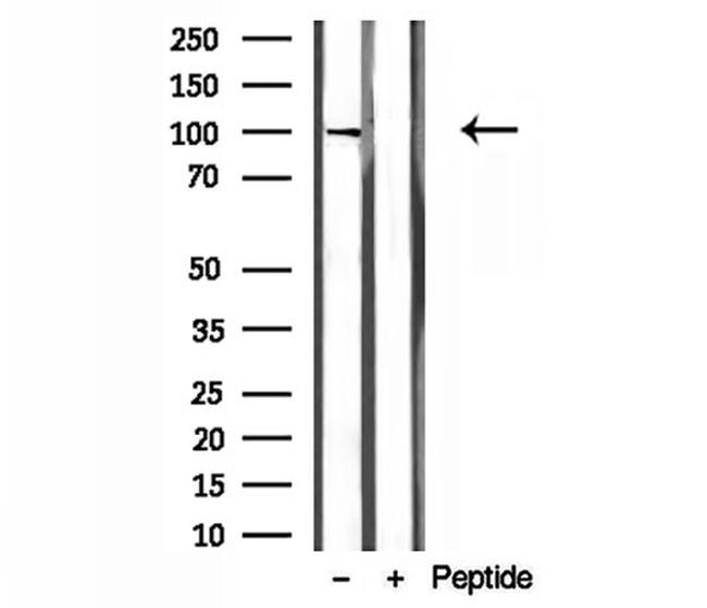 NOD2 Antibody in Western Blot (WB)