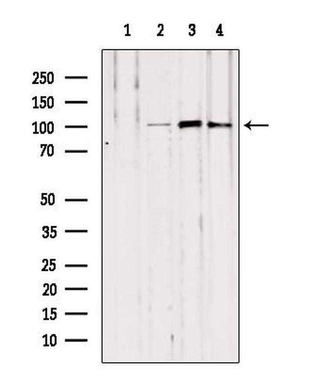 NOD2 Antibody in Western Blot (WB)