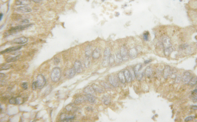 Phospho-eNOS (Ser1177) Antibody in Immunohistochemistry (Paraffin) (IHC (P))