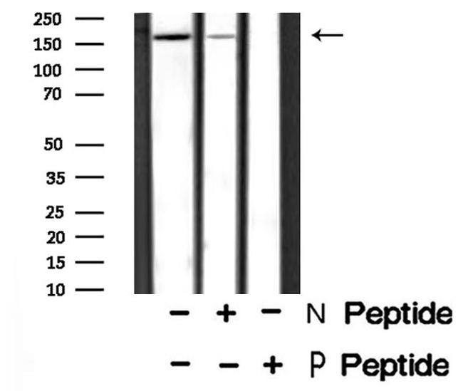 Phospho-FANCD2 (Ser717) Antibody in Western Blot (WB)