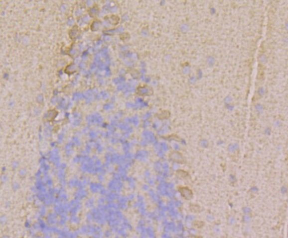 RyR1 Antibody in Immunohistochemistry (Paraffin) (IHC (P))