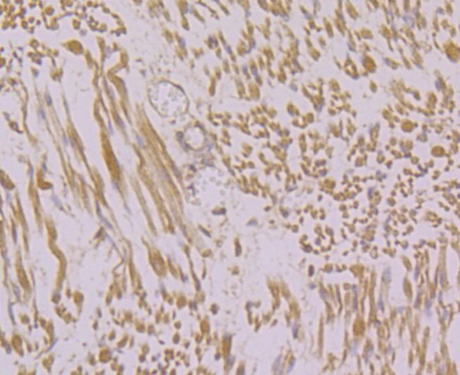 RyR1 Antibody in Immunohistochemistry (Paraffin) (IHC (P))