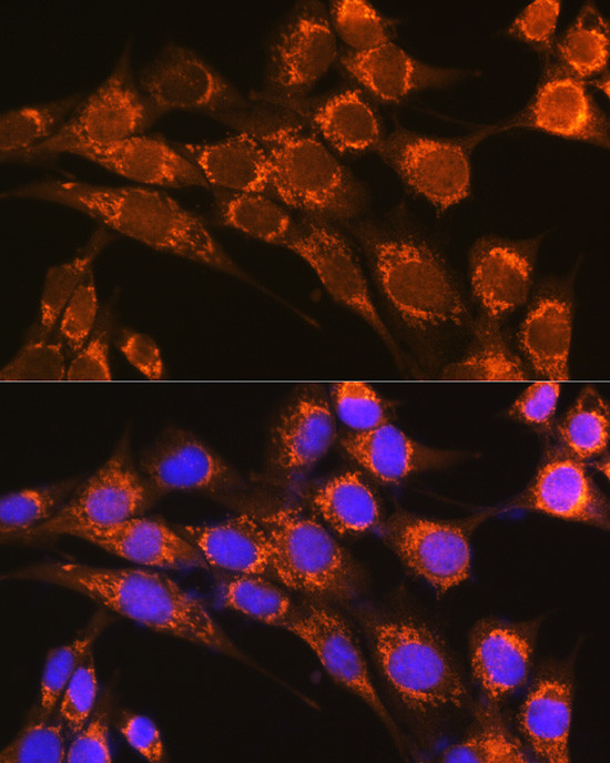 Properdin Antibody in Immunocytochemistry (ICC/IF)