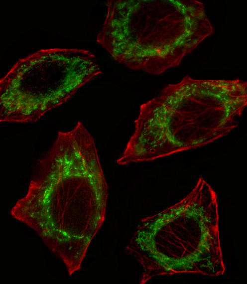 ALDH2 Antibody in Immunocytochemistry (ICC/IF)