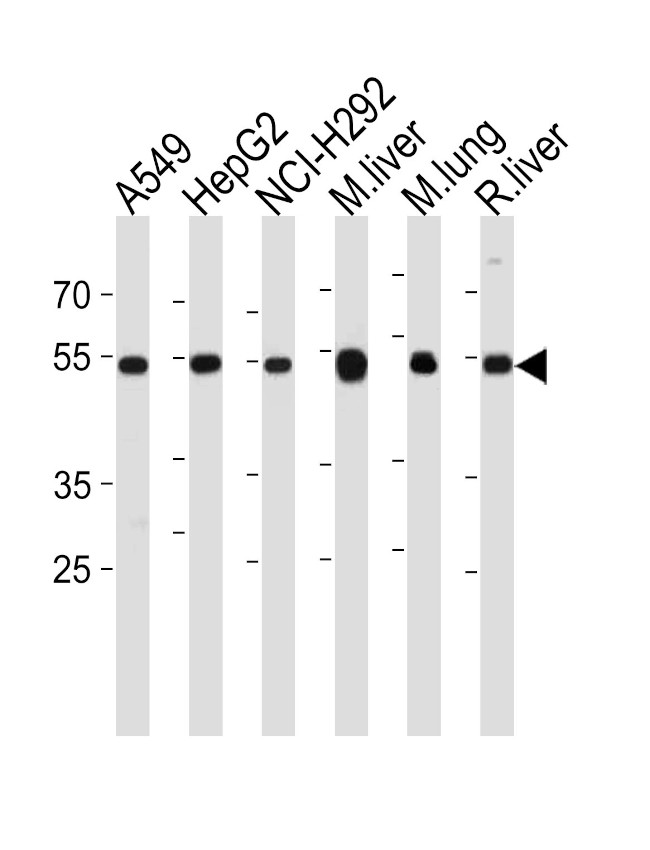 ALDH2 Antibody in Western Blot (WB)