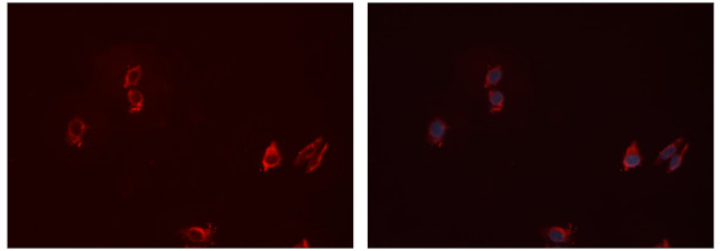 CD32 Antibody in Immunocytochemistry (ICC/IF)