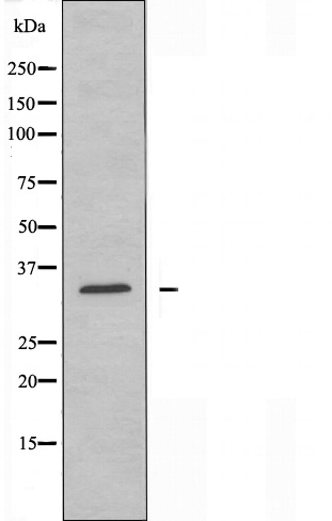 CD32 Antibody in Western Blot (WB)