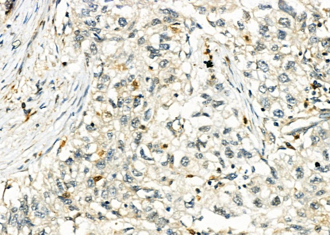 CTLA-4 Antibody in Immunohistochemistry (Paraffin) (IHC (P))