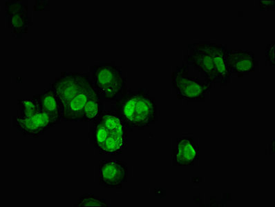 c-Jun Antibody in Immunocytochemistry (ICC/IF)