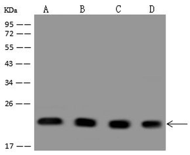 PARK7 Antibody in Western Blot (WB)