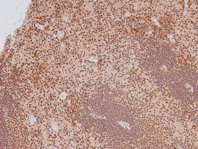 Phospho-Caveolin 2 (Ser36) Antibody in Immunohistochemistry (Paraffin) (IHC (P))