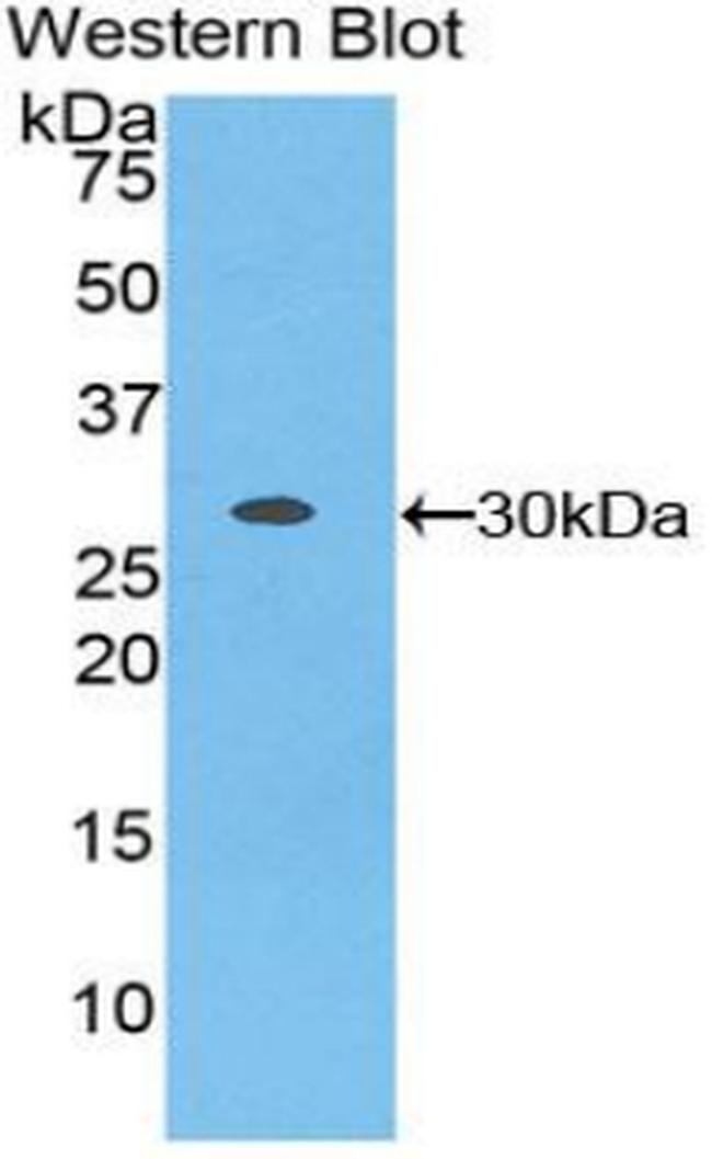 GARP Antibody in Western Blot (WB)