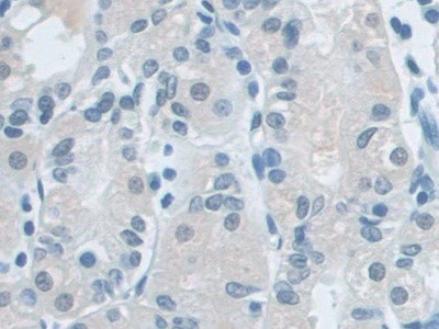 VCP Antibody in Immunohistochemistry (Paraffin) (IHC (P))