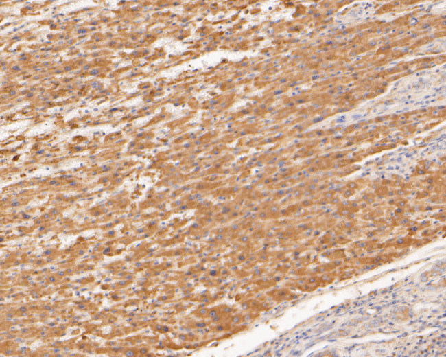 TREM2 Antibody in Immunohistochemistry (Paraffin) (IHC (P))