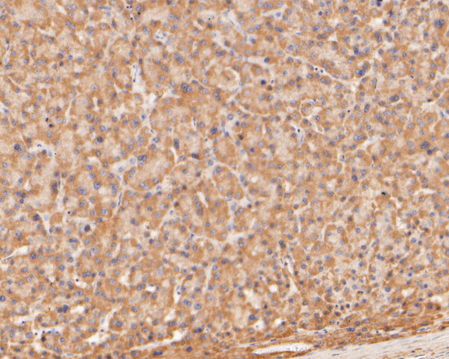 TREM2 Antibody in Immunohistochemistry (Paraffin) (IHC (P))