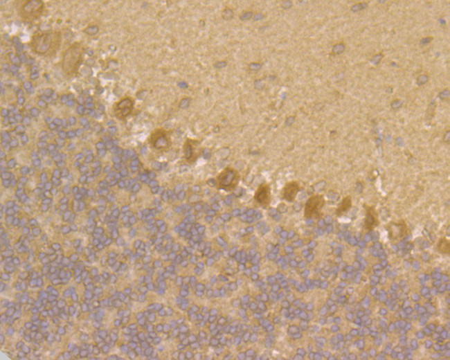 JNK2 Antibody in Immunohistochemistry (Paraffin) (IHC (P))