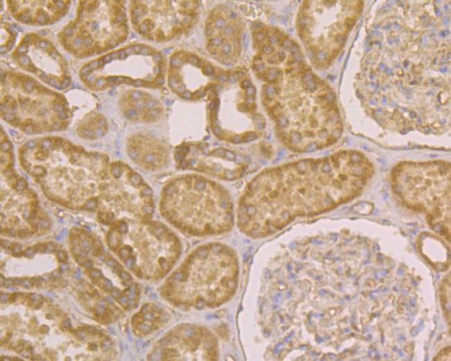 JNK2 Antibody in Immunohistochemistry (Paraffin) (IHC (P))