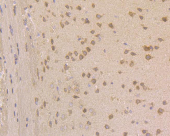 JNK2 Antibody in Immunohistochemistry (Paraffin) (IHC (P))