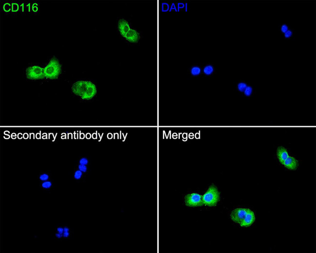 CD116 Antibody in Immunocytochemistry (ICC/IF)