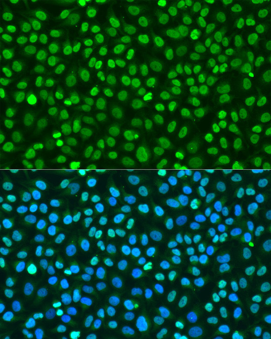 Histone H2A.X Antibody in Immunocytochemistry (ICC/IF)