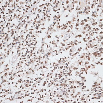 Histone H2A.X Antibody in Immunohistochemistry (Paraffin) (IHC (P))