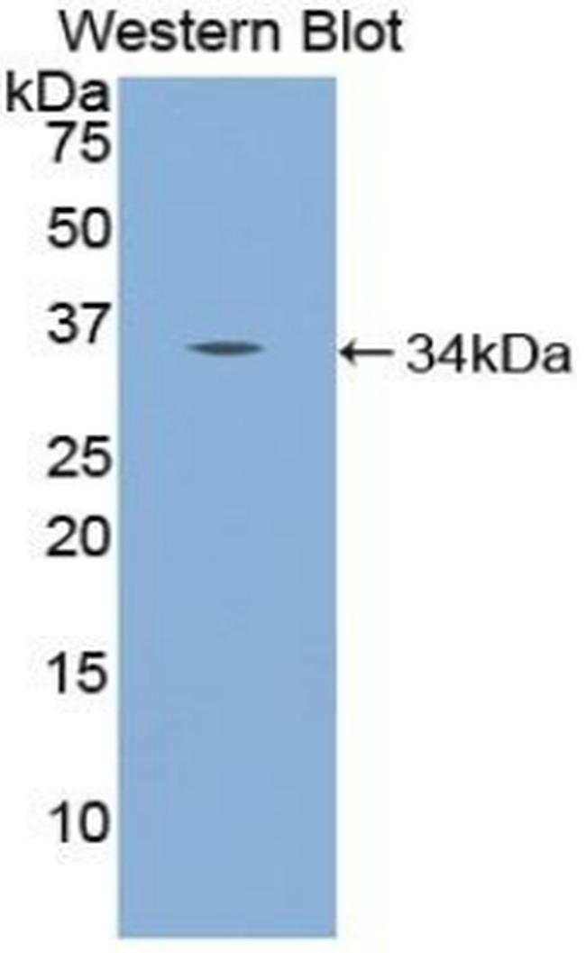 NUP98 Antibody in Western Blot (WB)