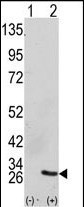 GRB2 Antibody in Western Blot (WB)