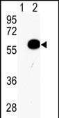 AKT2 Antibody in Western Blot (WB)