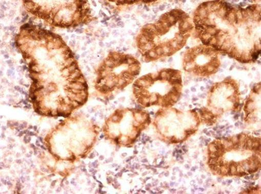 EIF2S1 Antibody in Immunohistochemistry (Paraffin) (IHC (P))