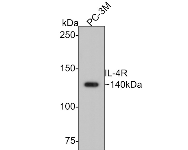 IL4R Antibody in Western Blot (WB)