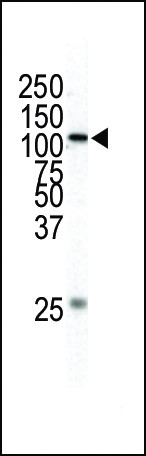 MEKK1 Antibody in Western Blot (WB)