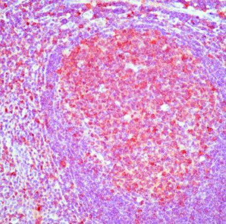 Caspase 3 Antibody in Immunohistochemistry (IHC)